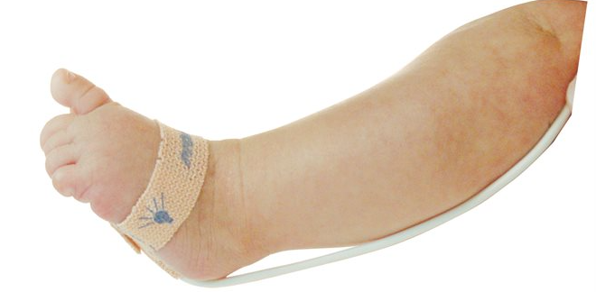 Nonin SpO2 Sensor, Sub-D, Single Use Microfoam, Neonatal, 1m (Box of 24) Product Code: 7000N-24