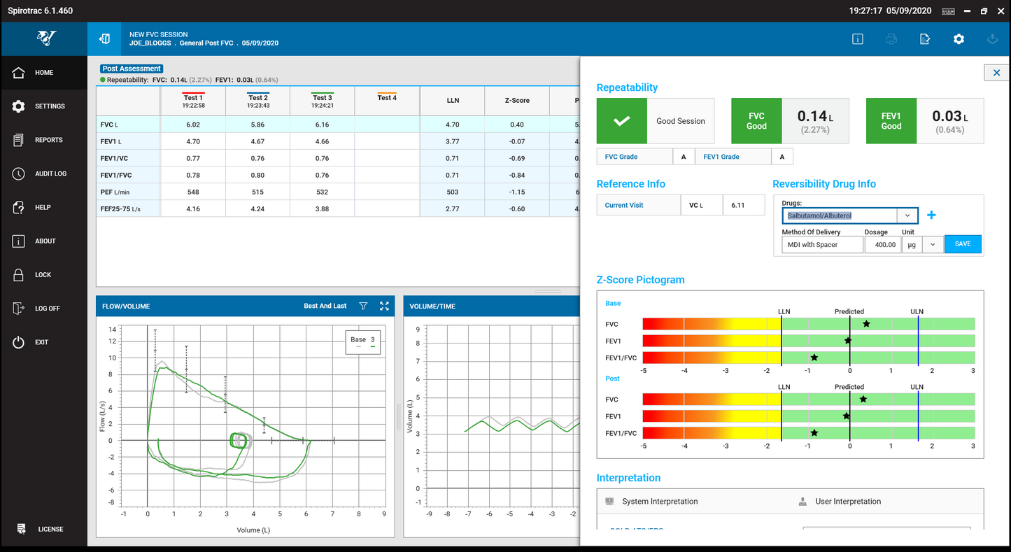 Vitalograph - Spirotrac® 6 Spirometry Software