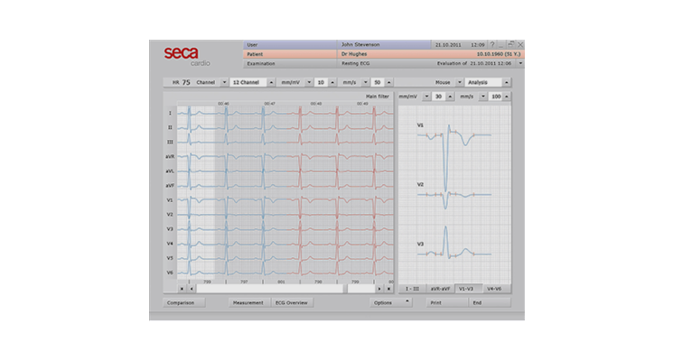 Refurbished Seca CT320 USB ECG Machine