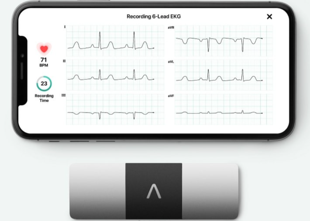 AliveCor KardiaMobile ECG 6 Lead