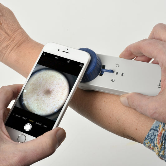 Opticlar - iPhone Connector for Compact D-Scope, various iPhone models