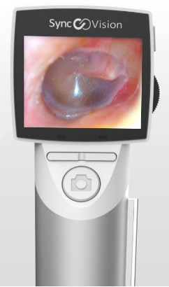 Video Otoscope (Digital otoscope-iO1 Elite)