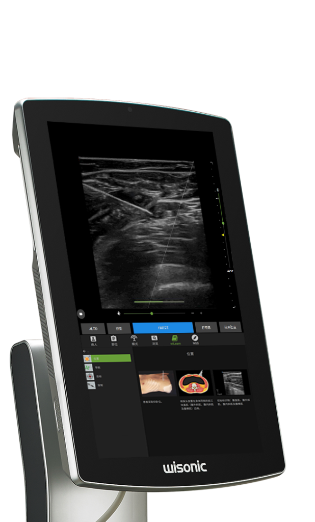 Navi- Portable Ultrasound (price on application)