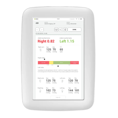 Mesi- Mtablet Wireless Ankle Brachial Index Measuring System (SMART) ABI