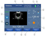 Bladder Scanner HD5