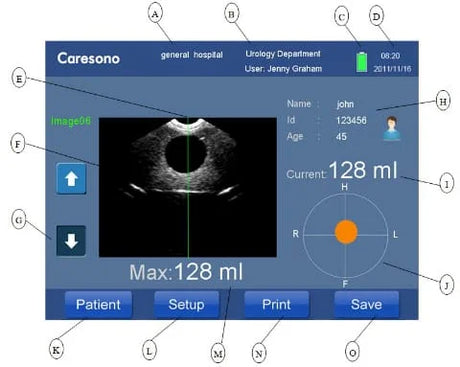 Portable Bladder scanner results