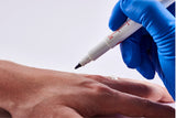 Surgical Skin Marker Pens