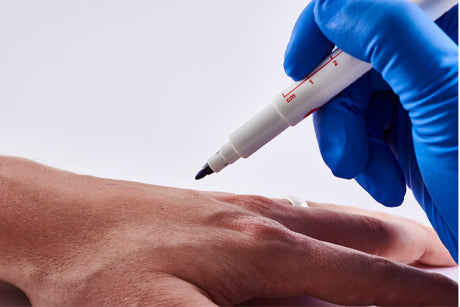 Surgical Skin Marker Pens