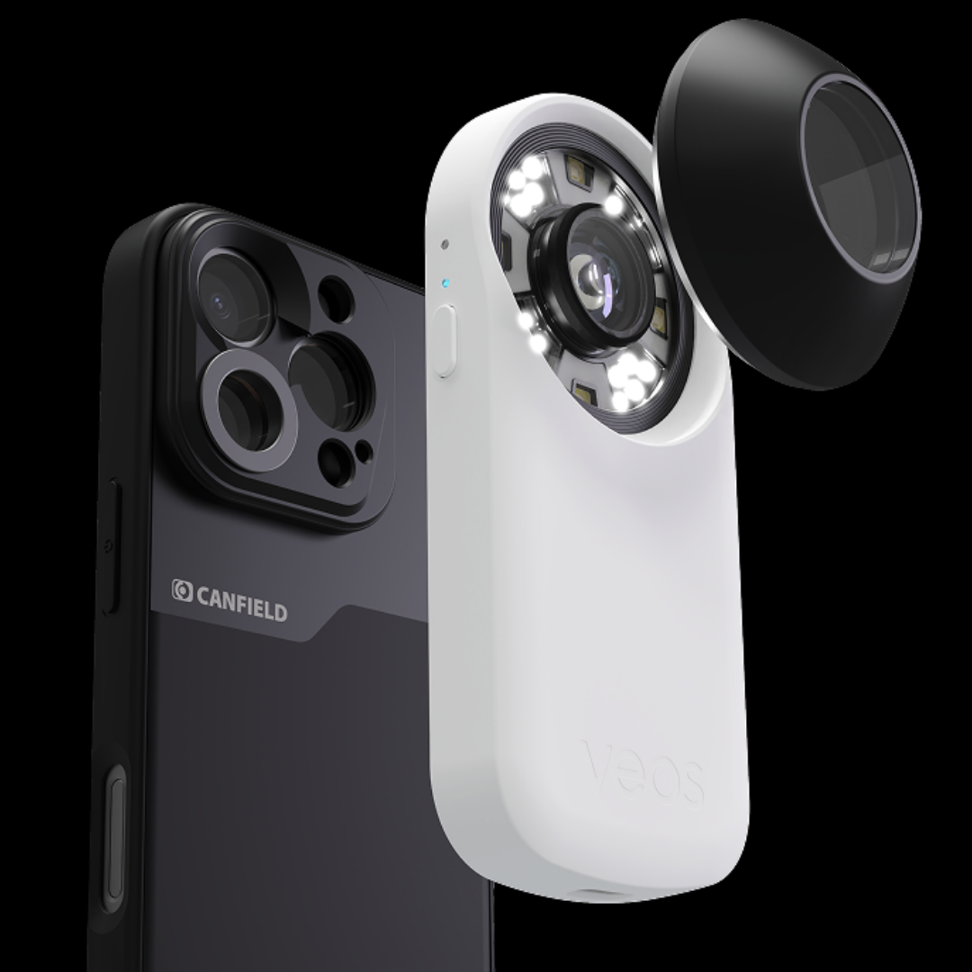 VEOS Portable Dermatoscope | Imaging Solution | 12.5x Mag | Contact & Non-Contact Cones