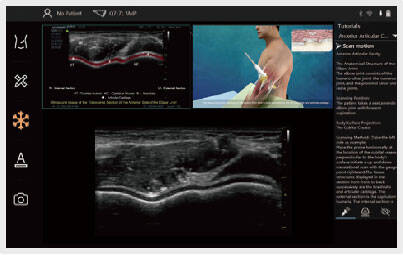 Vinno Q Hand Held Ultrasound Scanner