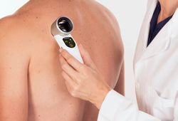 Luminis Dermatoscope