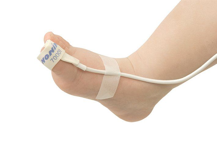 Nonin Infant Flexi-Form II™ Disposable Wrap Sensors (1m Cable)