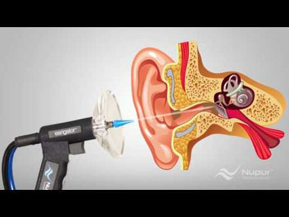Earigator- Wax removal system