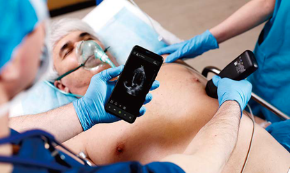 Vinno P – Handheld Ultrasound Probe