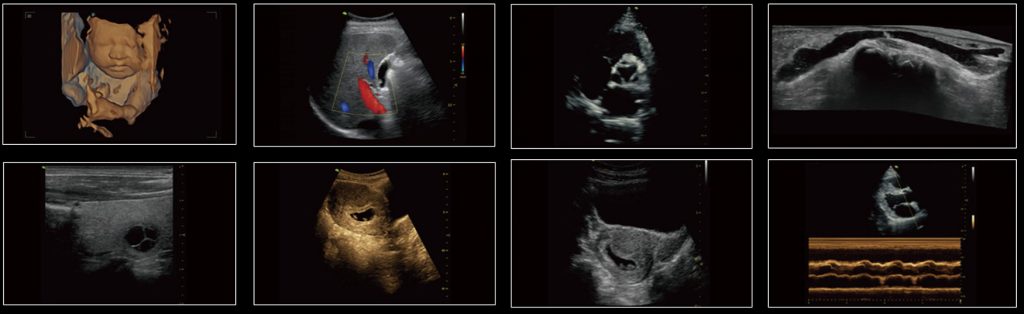 A5 Vinno Portable Ultrasound Colour Doppler