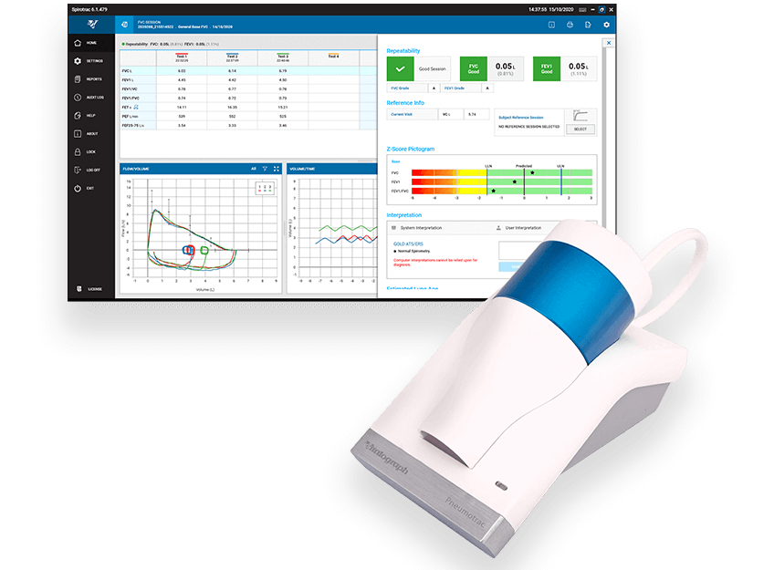 Vitalograph - Pneumotrac Spirometer with optional software