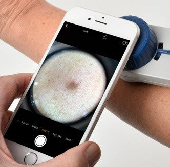 AW Opticlar-CompactD-ScopeDermatoscope 3