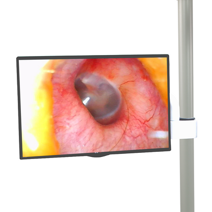 Opticlar - Zumax LED Dental/ ENT Microscope - 6 Step Focusing