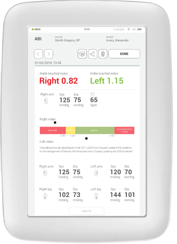 Mesi- Mtablet Wireless Ankle Brachial Index Measuring System (SMART) ABI