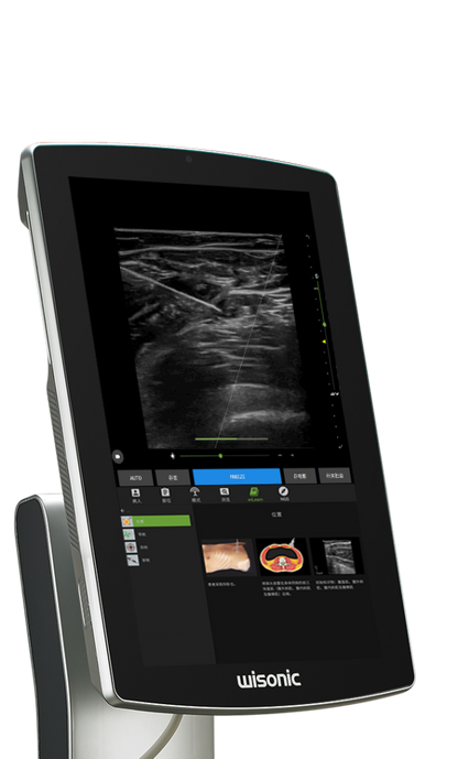 Navi- Portable Ultrasound (price on application)