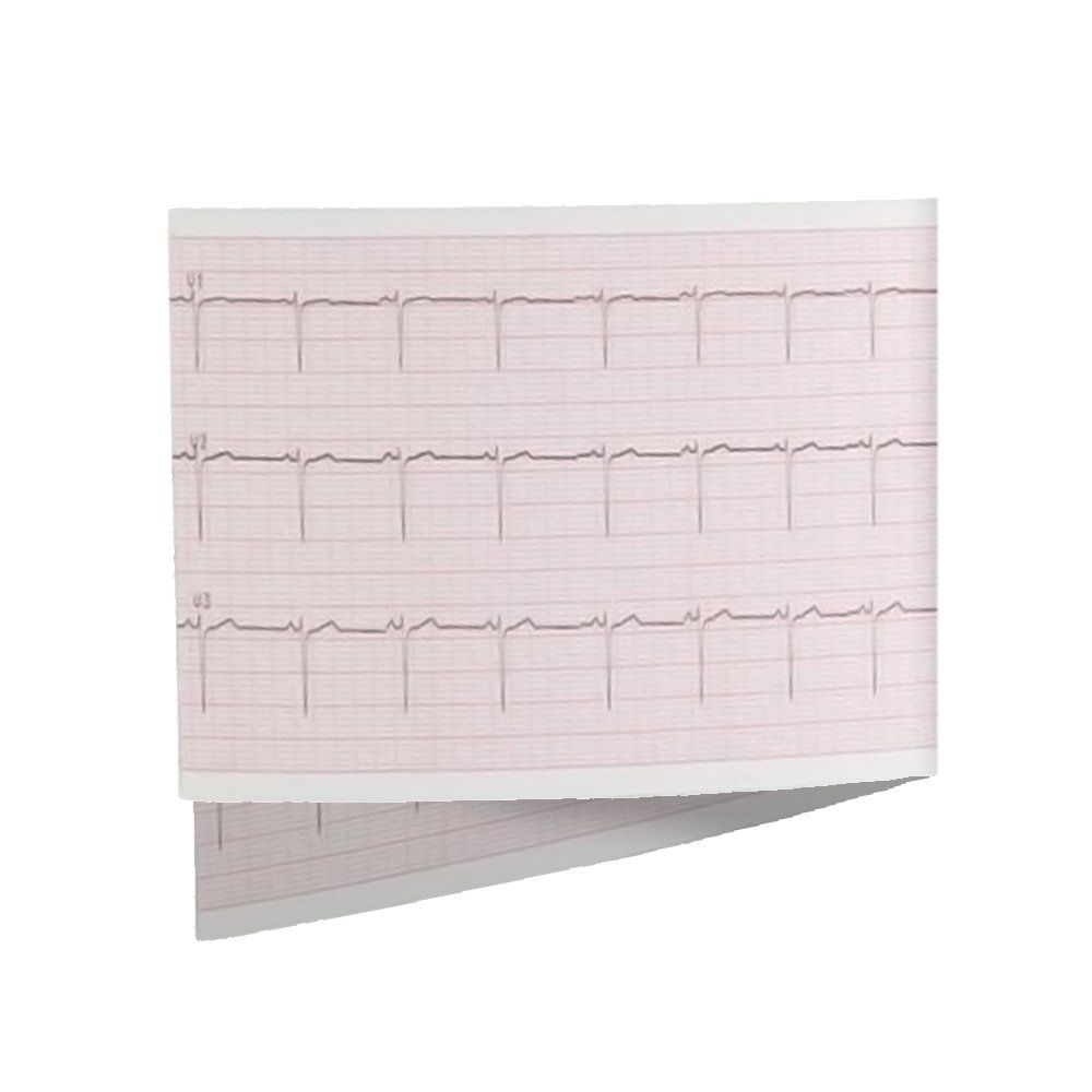 Seca 492.Pad-2 - ECG Paper for all CardioPad -2 (5 pack)